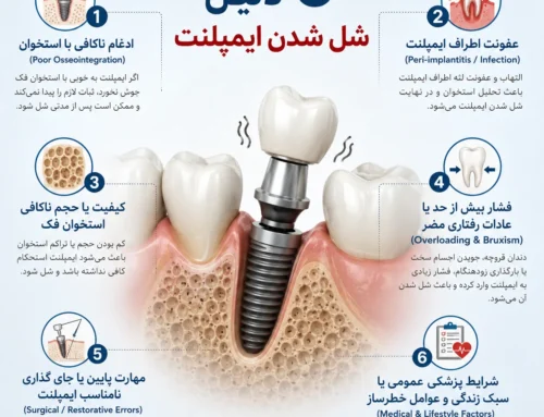 ۶ دلیل اصلی شل شدن ایمپلنت دندان